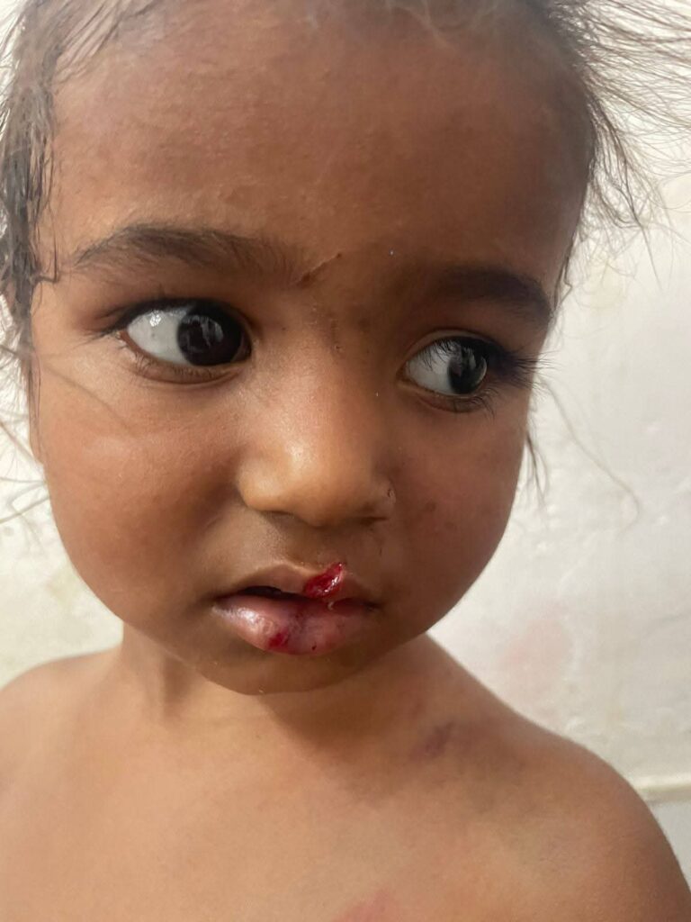 बस्ती मासूम बच्ची पिटाई मामला