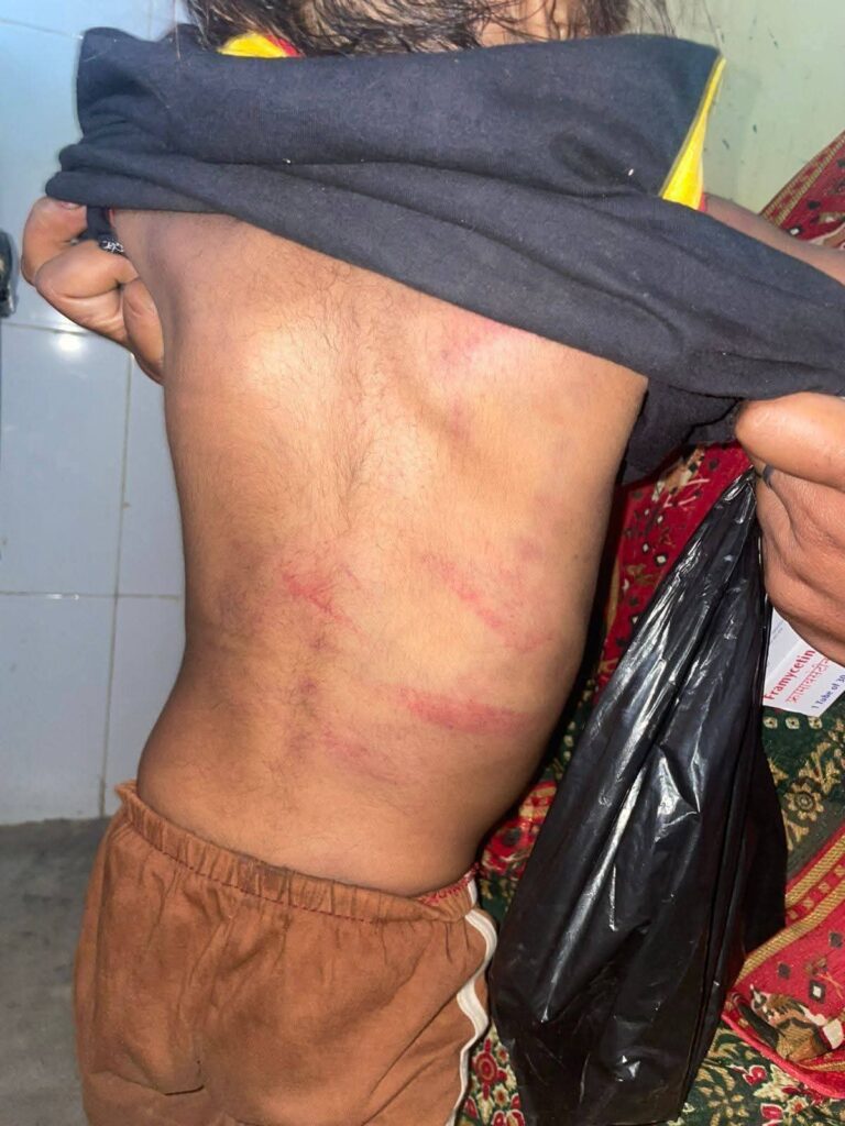 बस्ती मासूम बच्ची पिटाई मामला