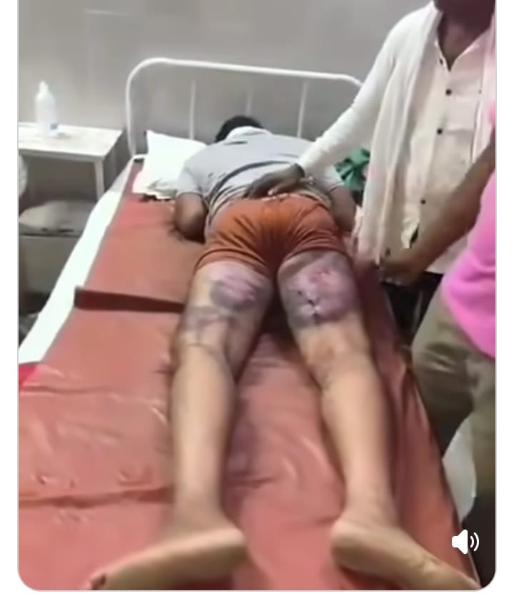 Gorakhpur Pipraich Police Beating Case